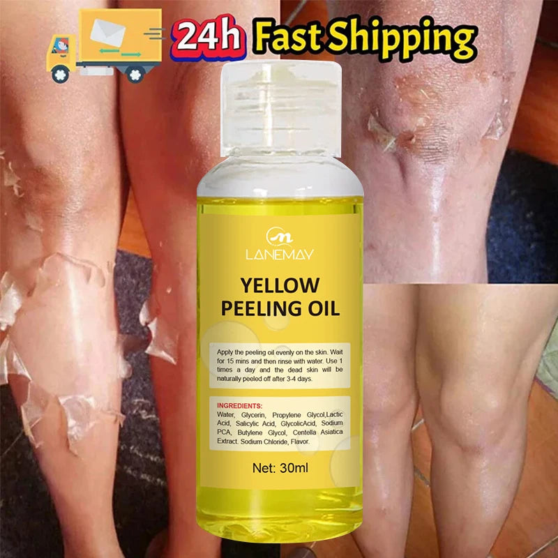 Body Care Exfoliating Yellow Peeling Oil 100% Organic Bleaching Dark Skin Serum Dark Knuckles Fast Whitening Korean Cosmetics