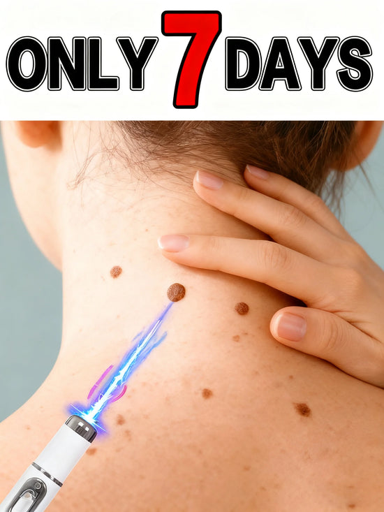 Best-Selling Blue Light Pen: Effective for Body Wart Removal & Wart Care